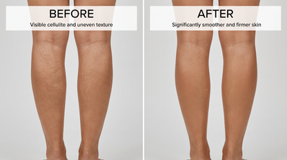 Transform Your Skin with Our 240ml Anti-Cellulite Massage Oil - Enriched with Collagen and Stem Cells for a Firm, Smooth, and Youthful Glow!